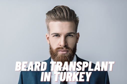 beard transplant in Turkey