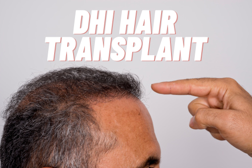 DHI hair transplant