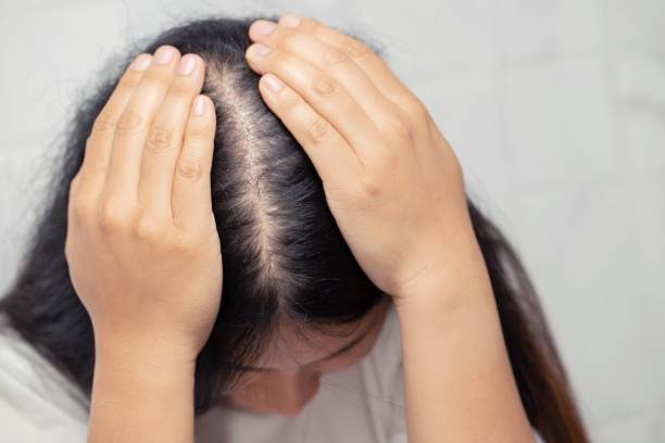 early sign of female pattern baldness